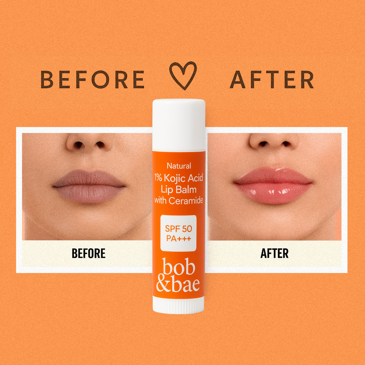 Lip Brightening Balm with SPF 50+ & 1% Kojic Acid, Ceramide & Peptide